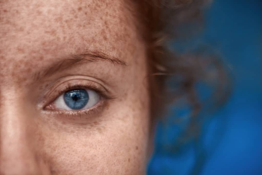 A close up image of a red haired womans blue eye ball. She has freckles all over her face. 