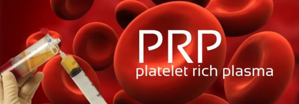 Platelet Rich Plasma (PRP) Swansea, IL