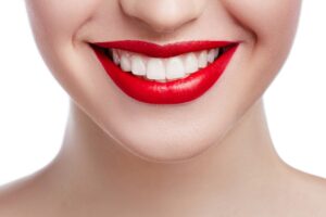 woman smiling after Juvederm