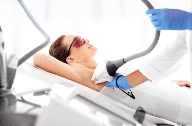 Womans underarm in laser hair removal