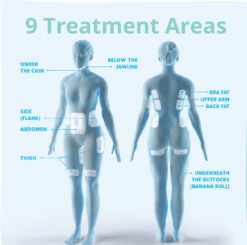 coolsculpting 9 treatment areas
