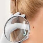 Oncologist examining female patient with magnifier in clinic
