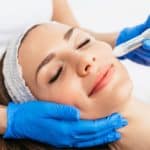 woman receiving microneedling rejuvenation treatment