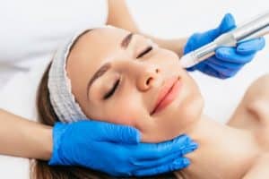 woman receiving microneedling rejuvenation treatment