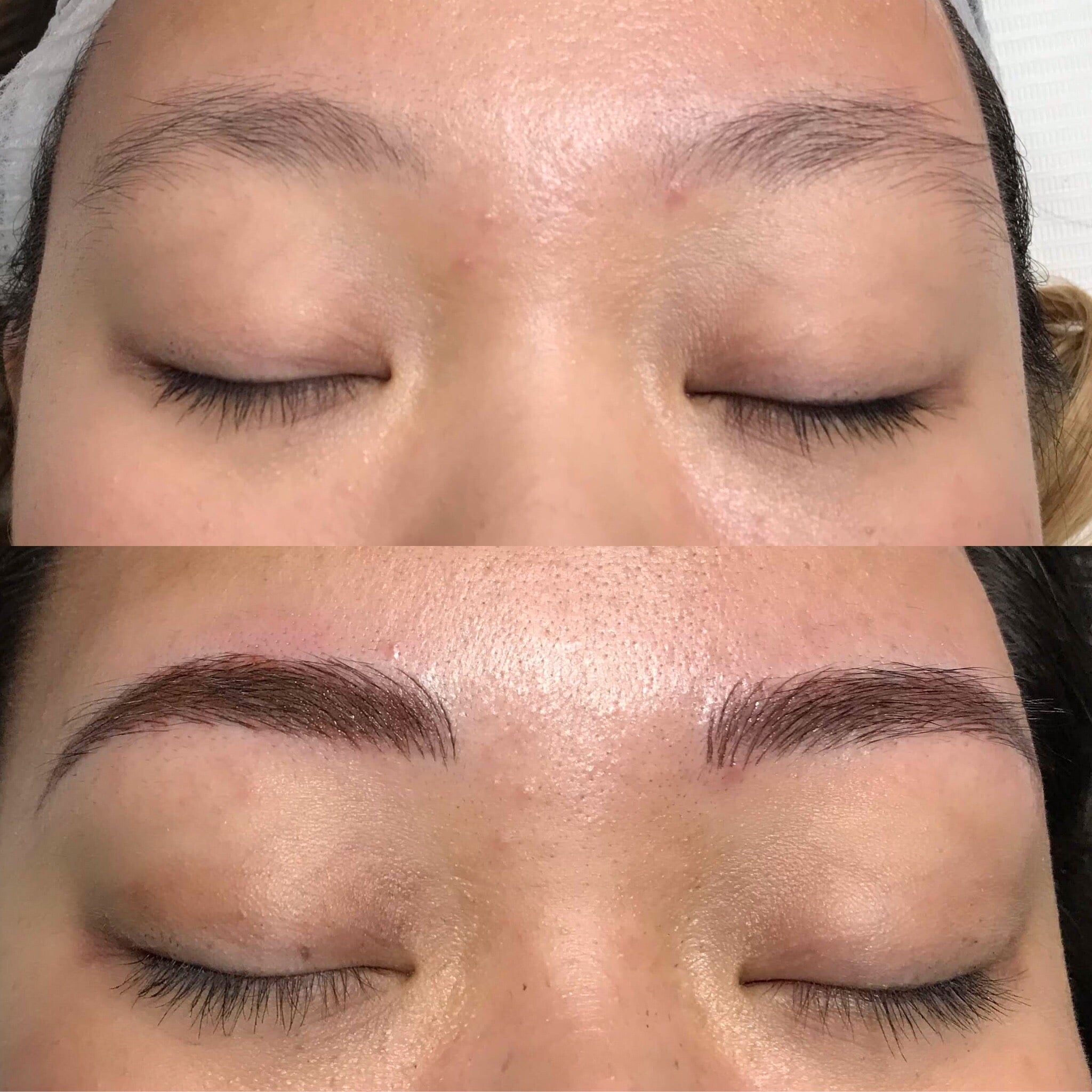 female patient’s eyebrows before and after microblading, eyebrows much fuller afterwards