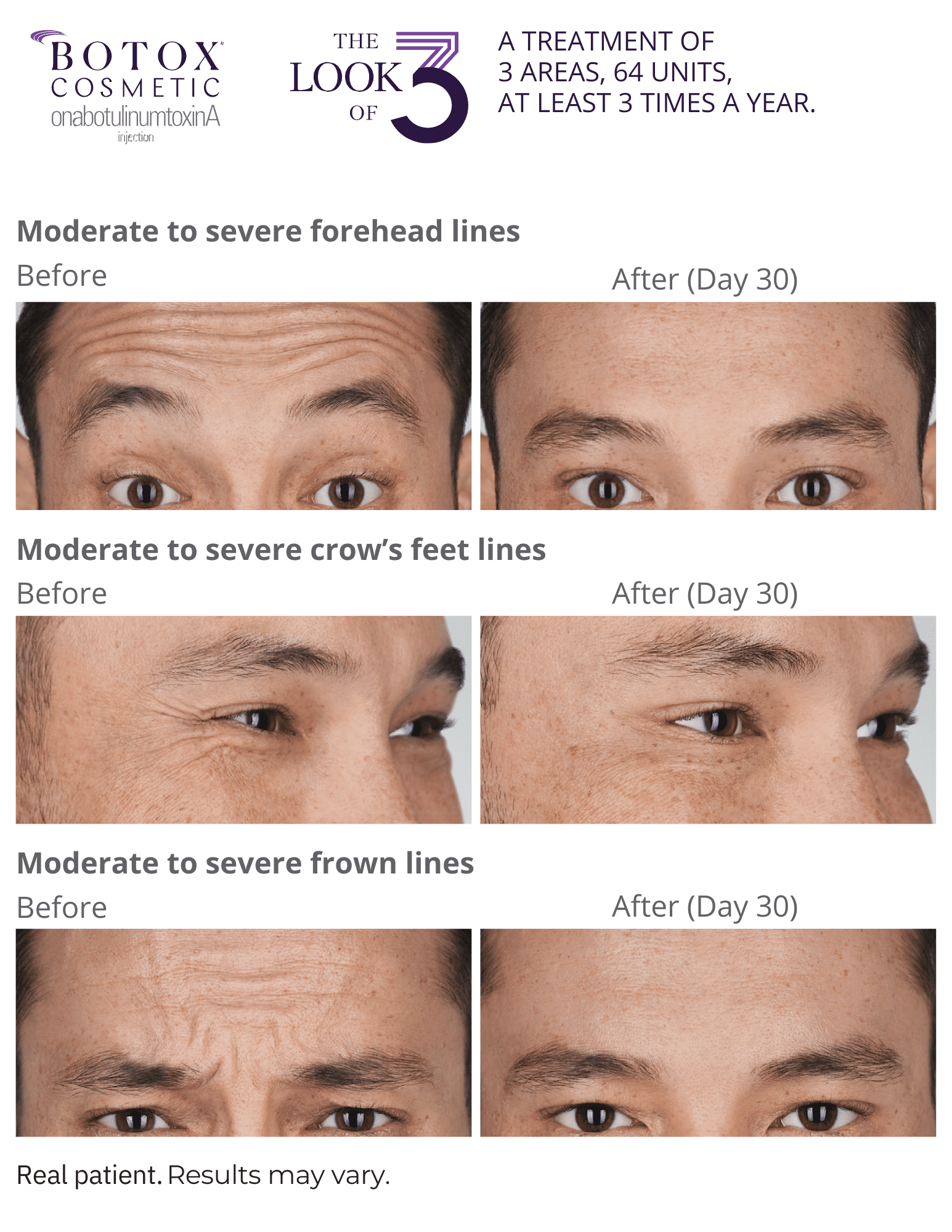 The Look of 3 from BOTOX Cosmetic Alex B&A.pdf (1)