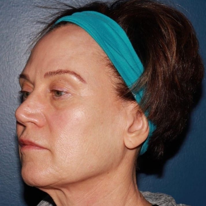 After Image: Secret RF - left-front-oblique