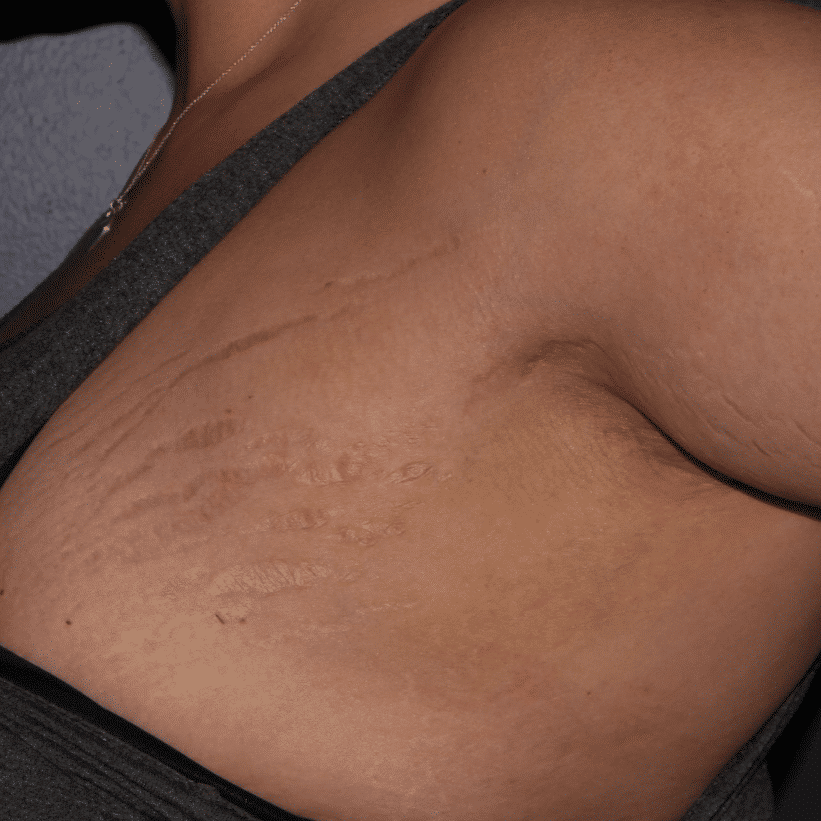 Before Image: Secret RF - left-front-oblique