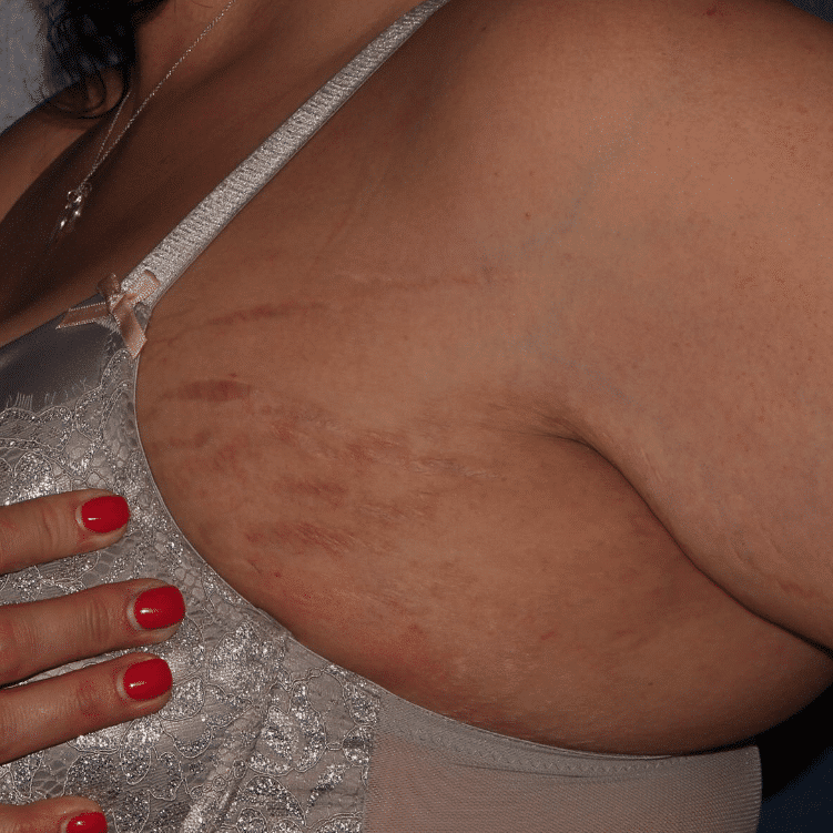 After Image: Secret RF - left-front-oblique