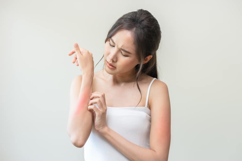 Woman scratching her reddened arm, suffering from eczema and in need of treatment.
