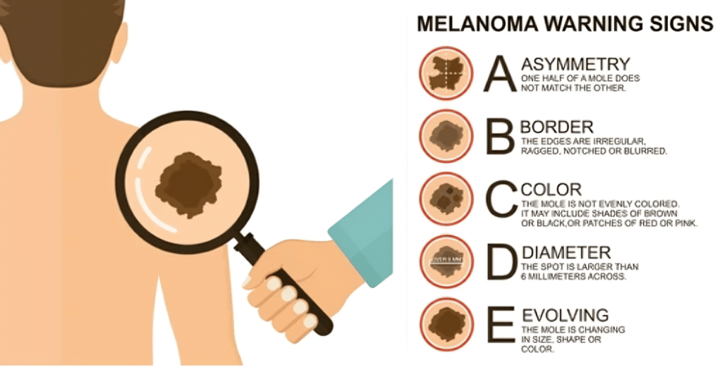 Skin Cancers in Swansea, IL