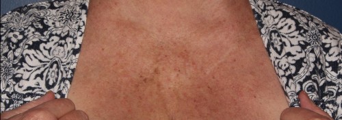After Image