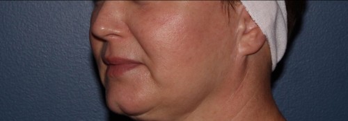 After Image