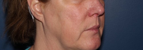 After Image