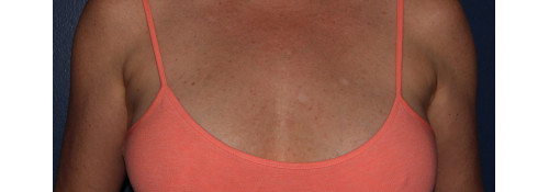 After Image
