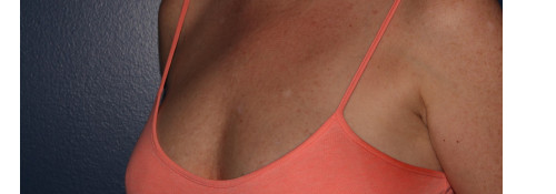 After Image