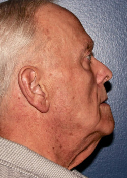 After Image