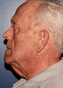 After Image