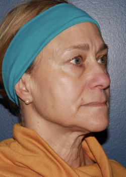 After Image