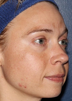 Before Image: Halo - right-front-oblique