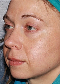 After Image: Halo - left-front-oblique