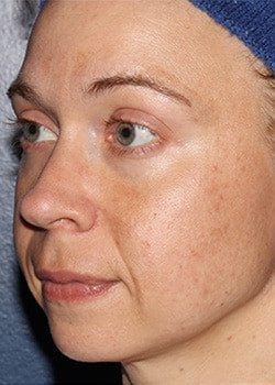 Before Image: Halo - left-front-oblique