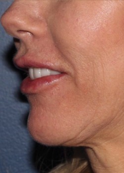 After Image