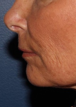 After Image