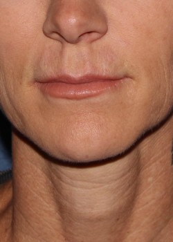 After Image