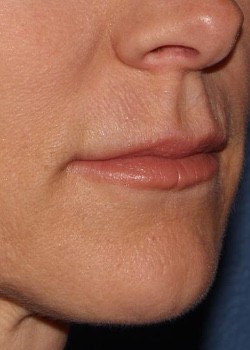 After Image