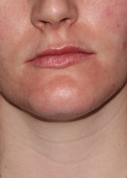 After Image
