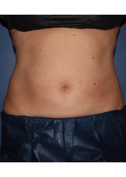 After Image
